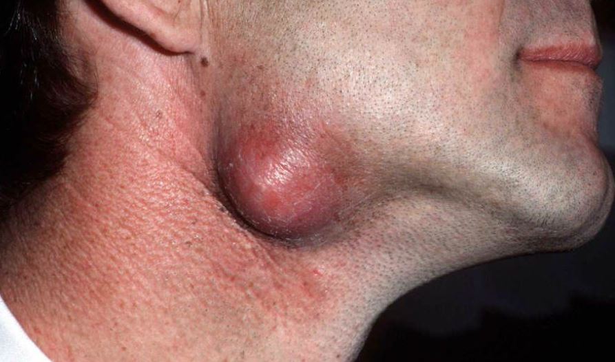 These are the signs that it’s gro…