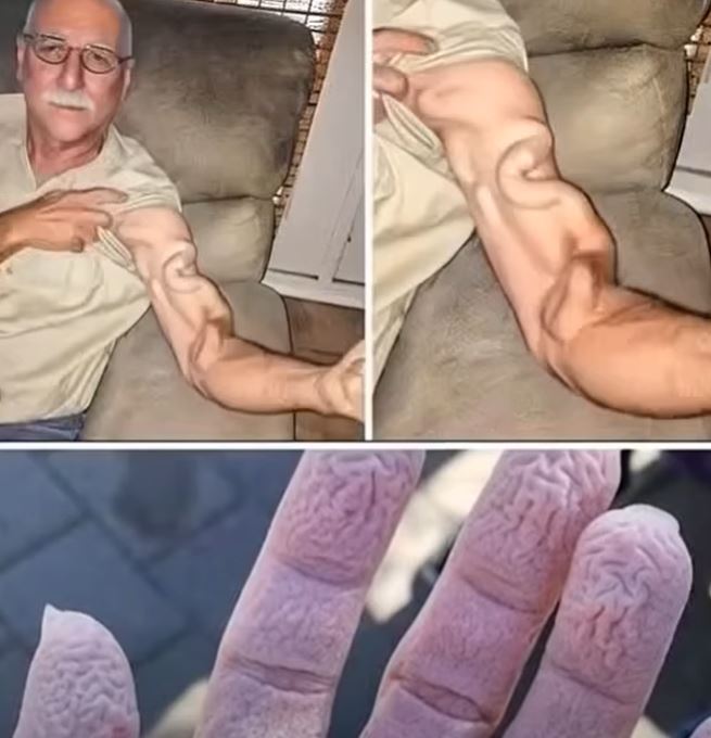 A Man Goes to Stretch and Ends Up Feeling a Sharp Pain in His Arm, It Was a Case That Shocked Everyone