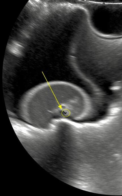 My daughter kept complaining of stomach pain. At the hospital, tests turned silent, then the doctor whispered urgent surgery, and my world collapsed as questions and fear flooded every thought.