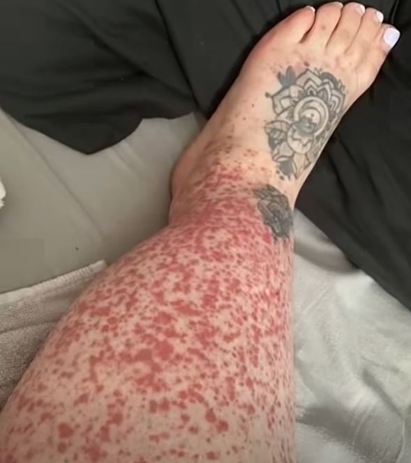 These are the consequences of sleeping with the…