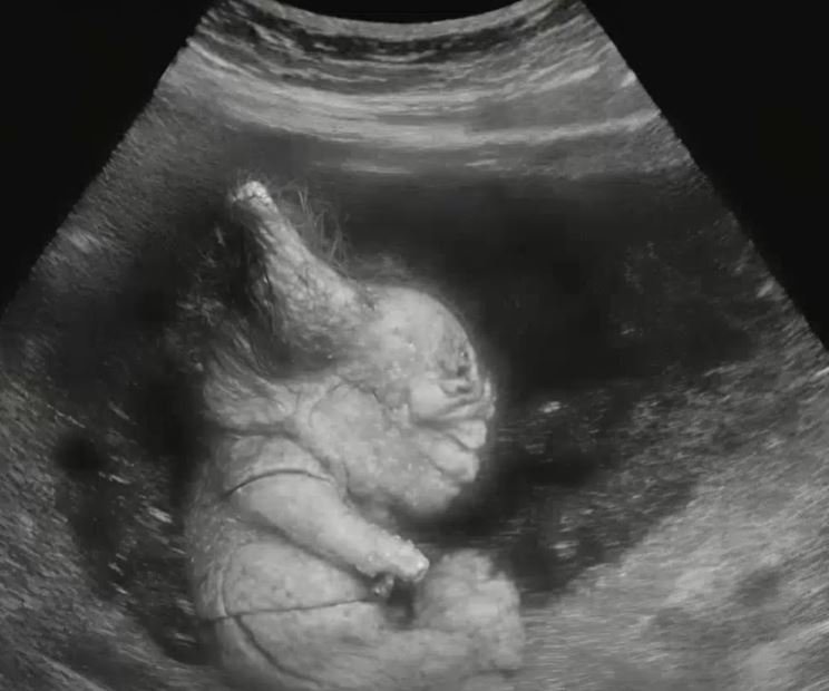 During an ultrasound during pregnancy, an unusual image appeared on the screen, which scared us, and only after seeing the child at birth.