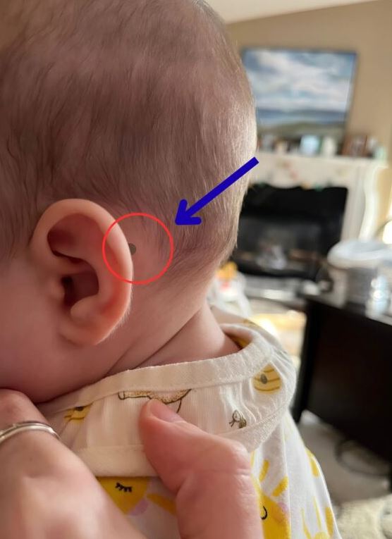 My newborn is only fifteen days old. After the bath, while I was combing his thin hair, I noticed something completely unexpected that shocked me and made me rush to the hospital, and what I found will surprise you.