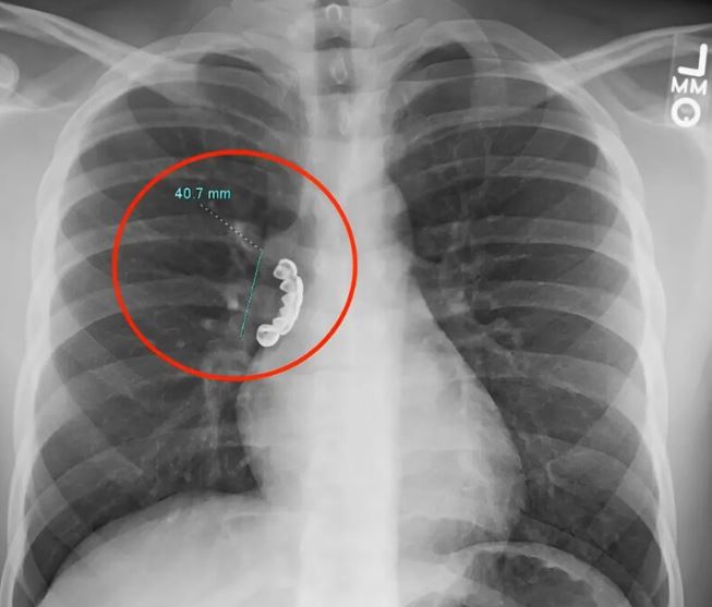 A secret that was hidden behind medical walls, but led to the discovery of a silent rescue, a dangerous breathing, a viral and unexpected fatal connection through a single accident.